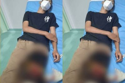 Remaja 15 Tahun di Tangsel Jadi Korban Begal, Motor Raib dan Kaki Dibacok Sajam