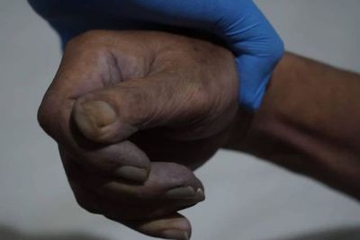 Mengenal Algor Mortis, Istilah Forensik Penurunan Suhu Tubuh Mayat