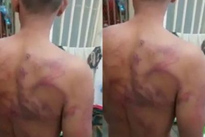 Heboh Narapidana di Tanjung Gusta Diduga Dianiaya Sipir, Ini Kata Kalapas
