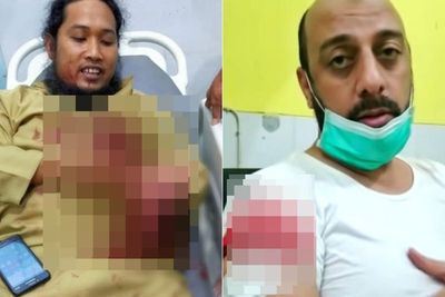 Berikut Tokoh Agama yang Pernah Diserang Sampai Bersimbah Darah saat Mengisi Ceramah