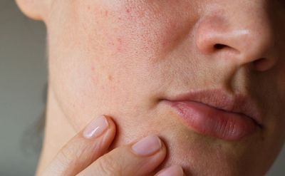 5 Masker untuk Kulit Kering dan Kusam dari Bahan Alami, Efektif!