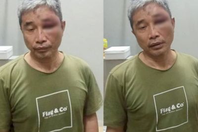 Propam Cari Unsur Kelalaian Petugas Rutan di Kasus Penganiayaan Muhammad Kece