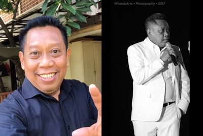 Dirut RS PON Bantah Tukul Alami Pendarahan Otak karena Divaksin