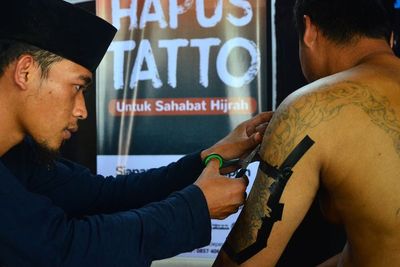 FOTO: Hapus Tato Gratis