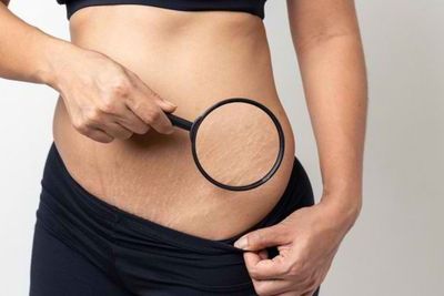 Viral Cerita Istri yang Kena Body Shaming Suami usai Melahirkan, Disebut Dekil dan Jelek