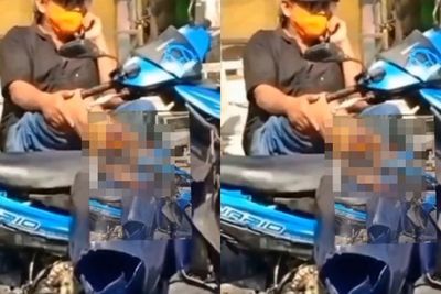 Kaki Putus Usai Diserempet Truk, Pria Ini Tetap Tenang Duduk di Motor Sambil Menelepon