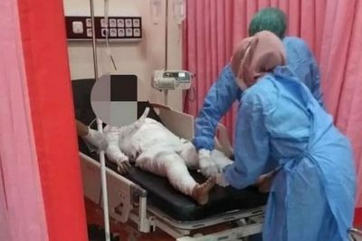 Suami Bakar Istri dan Anak Tirinya di Probolinggo Jatim, Polisi Beberkan Kronologinya