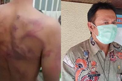 Terungkap! Napi yang Alami Luka Lebam di Lapas Tanjung Gusta Memang Dianiaya