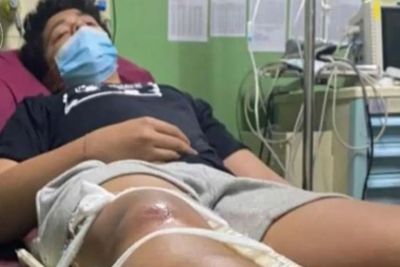 Bocah SMP Diduga Dianiaya Oknum Polisi di Denpasar, Disetrum dan Kaki Diinjak Hingga Patah