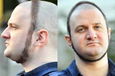 Pria Ini Cukur Rambut & Janggut Seperti Cincin di Wajah, Ada Alasan Mengharukan Dibaliknya