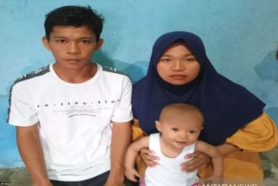 Memilukan, Bayi di Madina Derita Jatung Bocor, Orangtua Tak Punya Uang untuk Berobat
