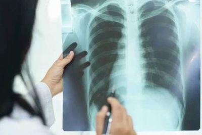 Bapak Ini Menolak Rawat Inap Meski Ruas Iganya Patah: Harus Cari Nafkah untuk Keluarga