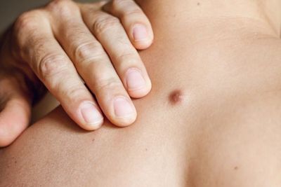 5 Cara Mengobati Bisul Agar Cepat Kempis dan Kering