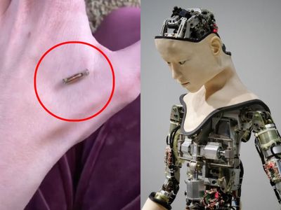 Viral Wanita Tanamkan Chip di Tangan, Ini Teknologi yang Bisa Berguna Bagi Tubuh Manusia