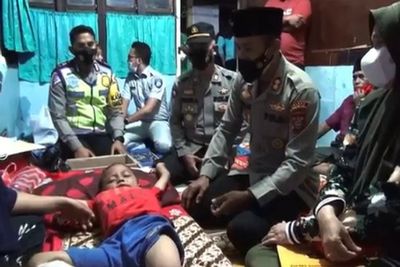 Gegara Dikejar Ayam, Bocah 6 Tahun di Madina Kecelakaan Sampai Patah Kaki