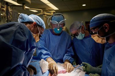 Ahli Bedah di AS Berhasil Transplantasi Ginjal Babi ke Tubuh Manusia, Ini Rahasianya