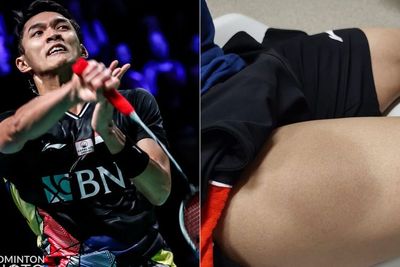 Cedera di French Open 2021, Jonatan Christie Perlihatkan Pahanya yang Bengkak