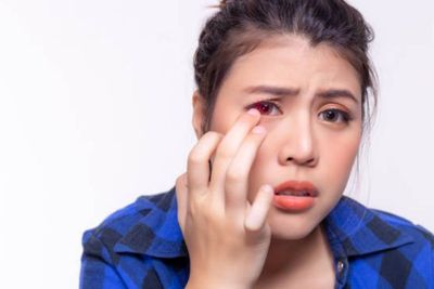 Ini 3 Cara Jitu Menghilangkan Kantung Mata