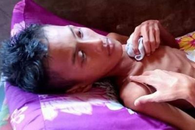 Perjuangan Edy Melawan Tumor Kerongkongan, Warga Medan yang Terancam Kehilangan Nyawa