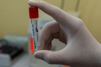 Afrika Selatan Deteksi Varian Baru Virus Corona, Diklaim Lebih Bahaya