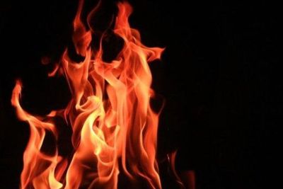 Kondisi Pengungsi Afghanistan Nekat Bakar Diri Hidup-hidup, Alami Luka Bakar 75 Persen