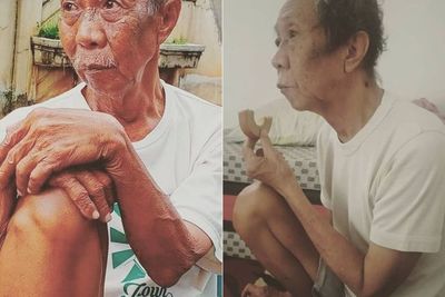 Kondisi Pak Ogah Kian Memprihatinkan: Daripada Aku ke Rumah Sakit, Mending Aku Mati