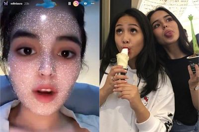 Pilu, Ini Postingan Terakhir Laura Anna Sebelum Meninggal Dunia: Bulu Mataku Rontok