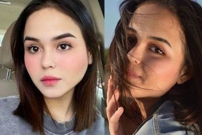 Mengenal Spinal Cord Injury, Sakit Selebgram Laura Anna Hingga Meninggal Dunia