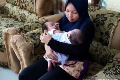 Memilukan, Terlahir Kembar Siam, Adam dan Malika Anak Warga Deliserdang Butuh Bantuan