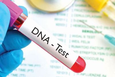 Mengenal Tes DNA yang Sempat Heboh karena Ayah Vanessa Angel
