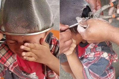 Momen Bocah Nangis Kepalanya Tersangkut Saringan Makanan, Pas Lepas Langsung Dibuang