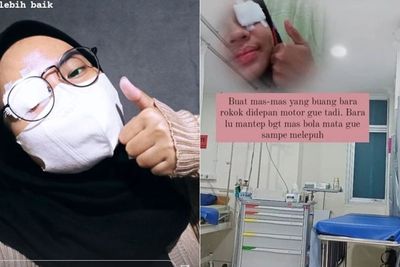 Viral Mata Cewek Melepuh karena Kena Rokok Pemotor, Ini Bahaya Bara Rokok Masuk ke Mata