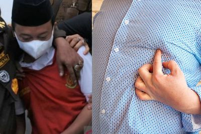 Mengenal Kebiri Kimia, Tuntutan Bagi Ustaz Herry Wirawan, Bisa Perbesar Payudara Pria