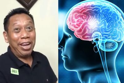 Kondisi Tukul Arwana Melemah Akibat Pendarahan Otak, Apa Penyebab dan Gejalanya?