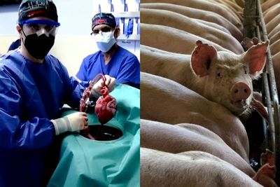 Ginjal Sudah, Jantung Sudah, Organ Babi Apa Lagi yang Bisa Dicangkokkan ke Tubuh Manusia?