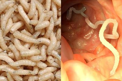 Akibat Gonta-ganti Pasangan, Bisakah Muncul Belatung di Organ Intim Wanita?