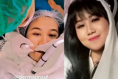 Tampil Glowing Usai Perawatan Rp80 Juta, Begini Treatment Kecantikan yang Dijalani Mayang