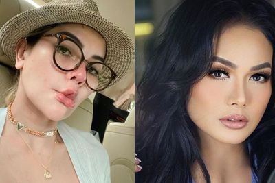 4 Artis Indonesia yang Melakukan Operasi Plastik, Keluarkan Biaya hingga Miliaran
