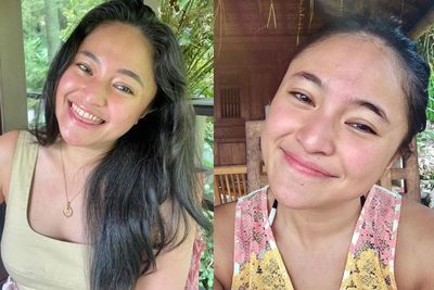 Idap Bipolar, Pesan Marshanda untuk Kamu yang Suka Self-Diagnosis Lalu Pamer di Medsos