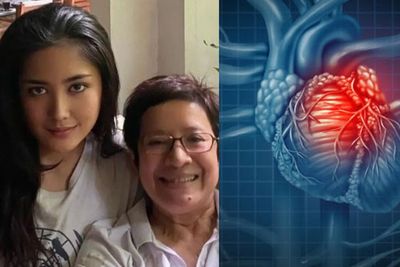 Anak Nurul Arifin Meninggal karena Henti Jantung, Ketahui Bedanya dengan Serangan Jantung