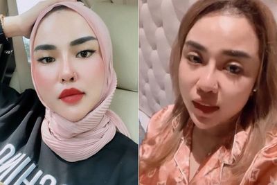 Medina Zein Dihujat Gegara Unggah Foto Seksi Usai Lepas Hijab, Disebut Pengalihan Isu