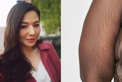 Alami Stretch Mark saat Hamil, Berikut Ini Cara Eriska Rein Mengatasinya