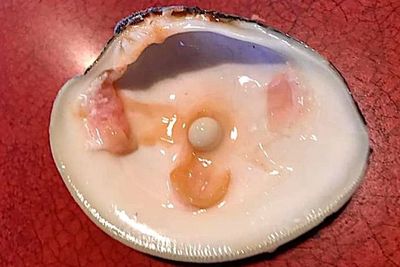 Pria Ini Mengira Giginya Retak, Ternyata Tak Sengaja Makan Mutiara Senilai 1,4 Miliar