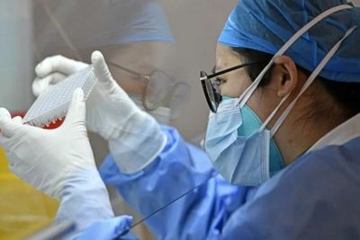 China Lagi Kembangkan Antibodi Hirup untuk Obat COVID-19, Diklaim Berhasil pada Hewan