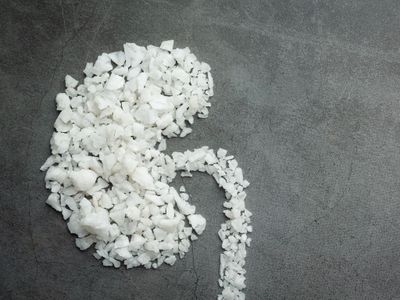 Hari Ginjal Sedunia, BPJS Kesehatan Tanggung Layanan untuk Pasien Gagal Ginjal