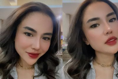 Berjilbab Sejak Kelas 3 SMP, Medina Zein Beberkan Alasan Lepas Hijab
