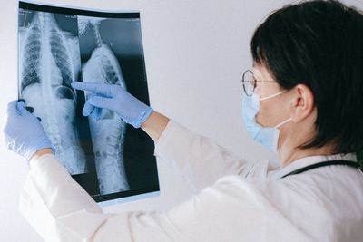 Tips Meminimalisir Kerusakan Paru-Paru usai Terpapar COVID-19