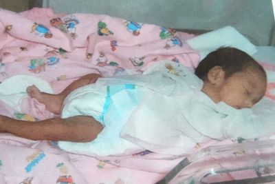 Bayi Prematur Beresiko Buta, Ini Langkah Waspada yang Bisa Dilakukan