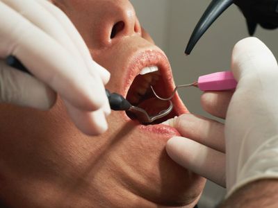 10+ Obat Sakit Gigi Berlubang Tradisional, Apotek, dan Medis