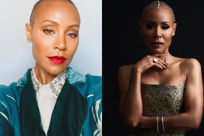 Mengenal Alopecia, Penyakit Jada Pinkett Smith yang Dijadikan Lelucon oleh Chris Rock